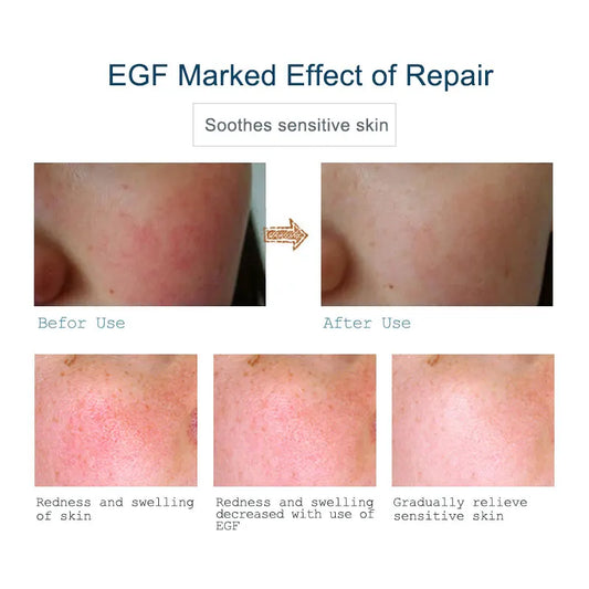 ARTISCARE EGF Face Serum for Women
